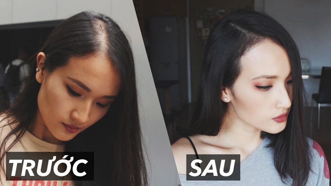 5 tiêu chí chọn mua thuốc mọc tóc an toàn 